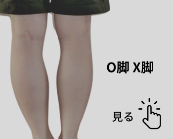 h&h立川駅前の鍼灸整骨院・整体院　お悩み別メニュー画像　O脚X脚