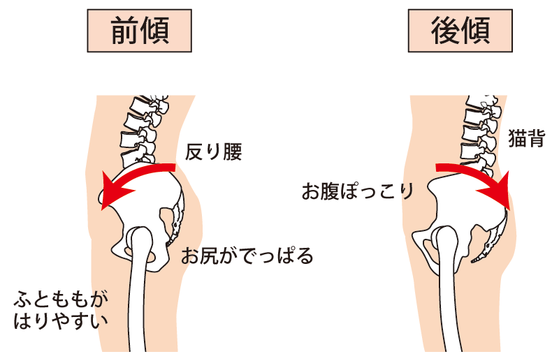 図解:骨盤の前傾と後傾
