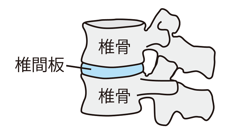 図解:椎間板