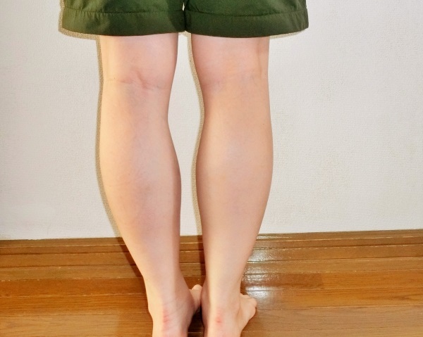 O脚イメージ